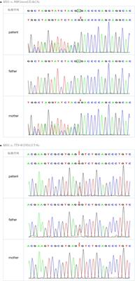 Citrullinemia type I in Chinese children: Identification of two novel argininosuccinate synthetase gene mutations